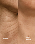 Crema al Collagene Post-Trattamento