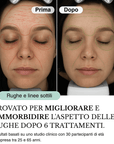 Sistema ad infusione Microneedling