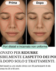 Sistema ad infusione Microneedling