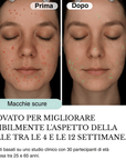 Sistema ad infusione Microneedling