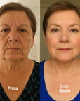 Crema al Collagene Post-Trattamento