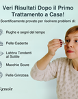 Sistema ad infusione Microneedling Anti-age